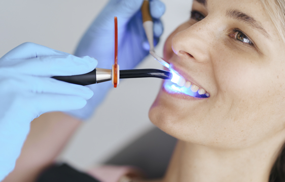 Dentistas en El Casar | Oeste Dental - Clínica dental en El Casar